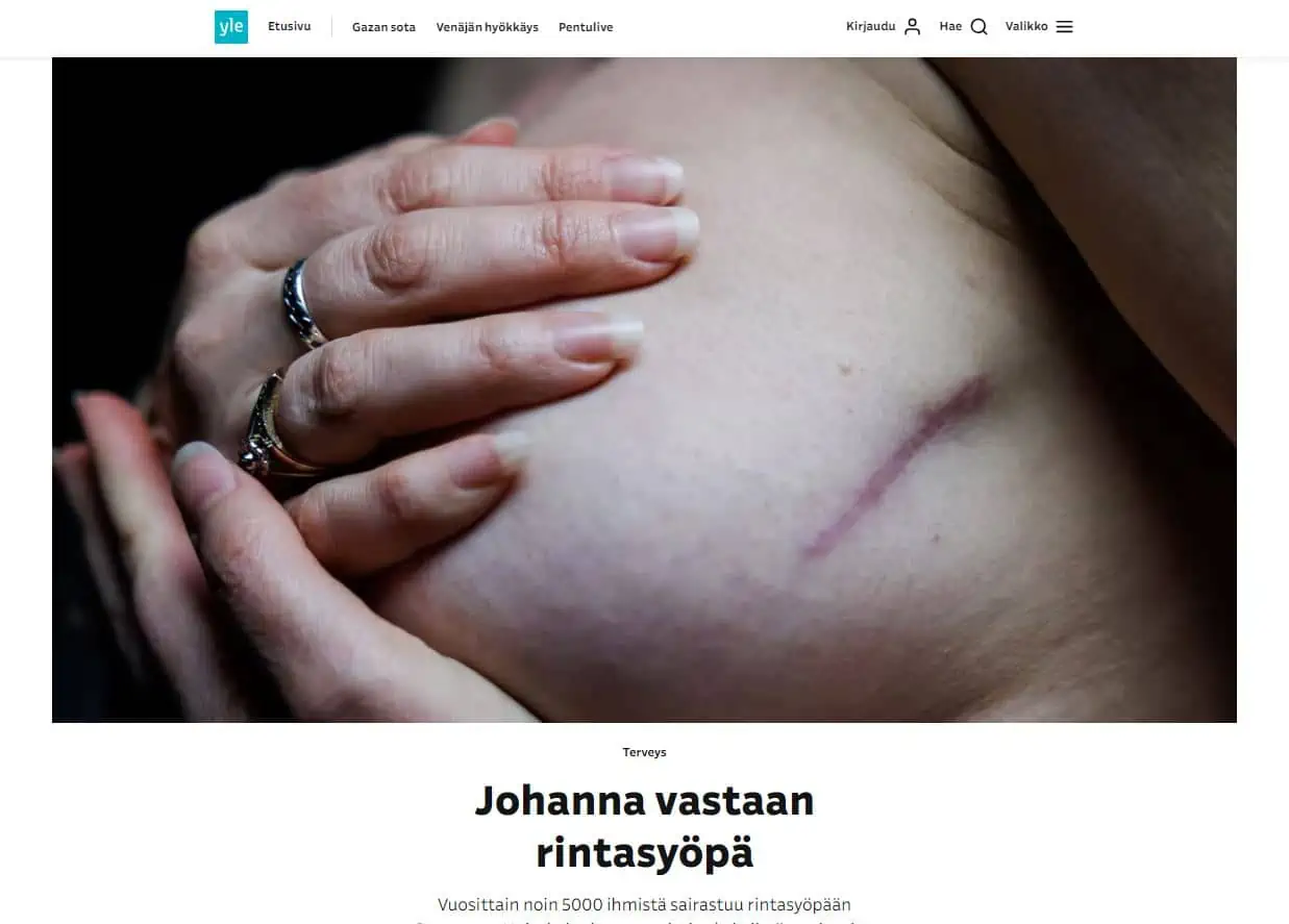 johanna pinksu rintasyöpä artikkeli yle