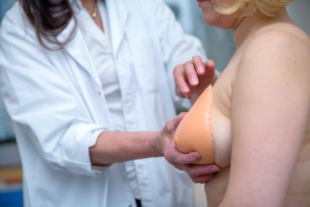 Terveydenhuollon ammattilainen sovittaa rintaproteesin mastektomian läpikäyneelle potilaalle kliinisessä ympäristössä.